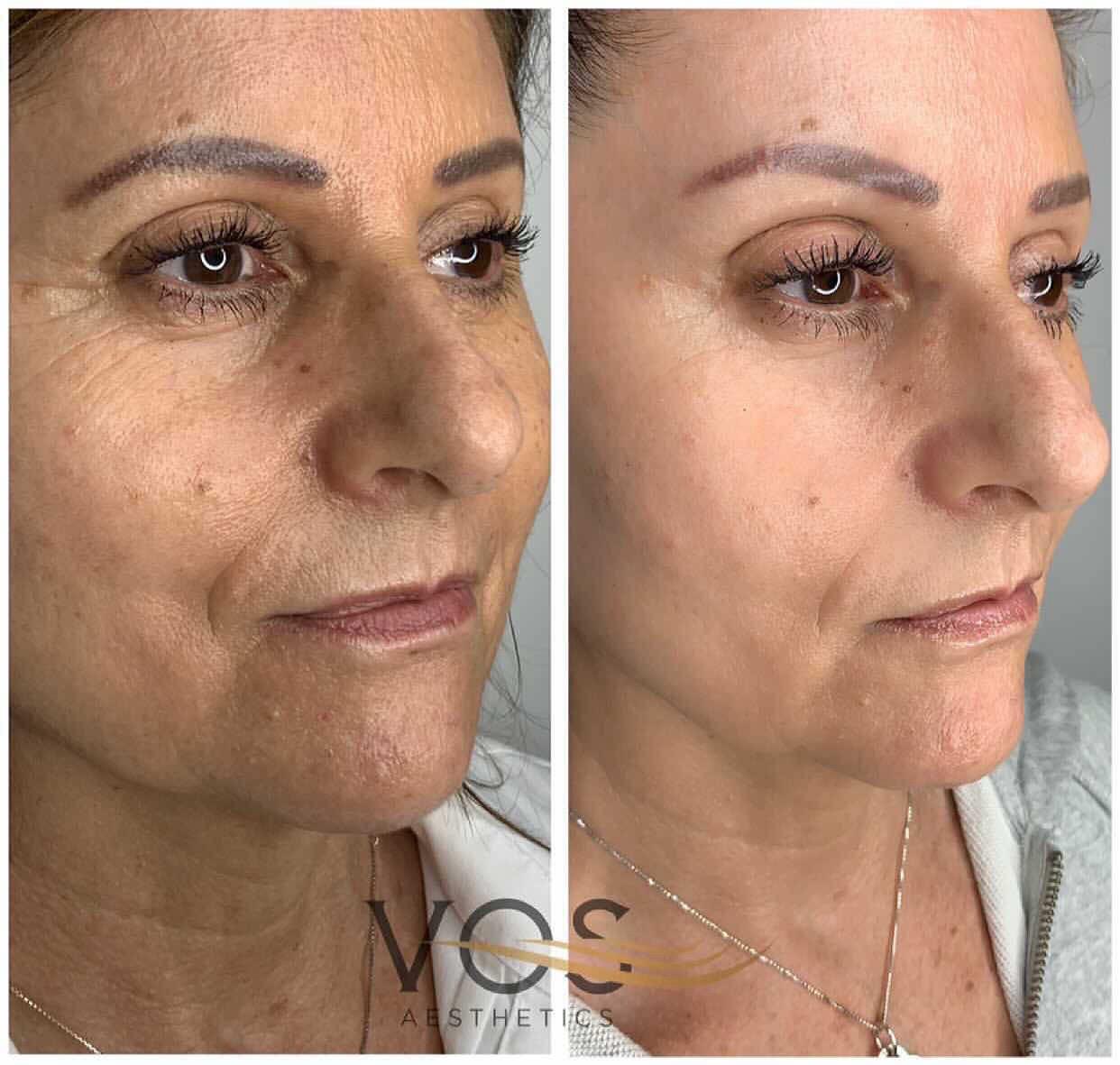 Two side-by-side client portraits showing a before-and-after comparison